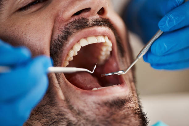 Best Laser Dentistry  in Lake Holiday, IN